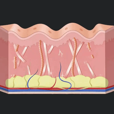 Step 2: Tighter, Smoother Skin